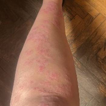 Hidzamom do balansa, Jaca